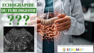 Echographie du tube digestif cest possible [upl. by Kirsch]