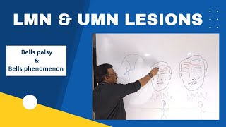 LMN amp UMN Lesions Made Easy  How to differentiate LMN amp UMN lesions [upl. by Taber]