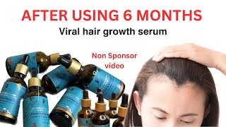 Unveiling the Truth 6Month using PILGRIM Redensyl amp Anagain Hair Growth Serum pilgrimserum [upl. by Rosecan]