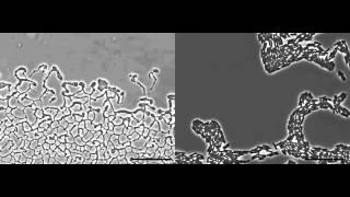 Pseudomonas aeruginosa biofilm expansion via twitching motility [upl. by Feldstein]