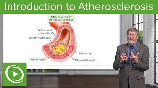 Introduction to Atherosclerosis  Cellular Pathology [upl. by Aneehsor]