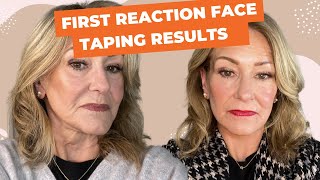 Face Taping Before and After A StepbyStep Guide and is it Right for you [upl. by Paik]