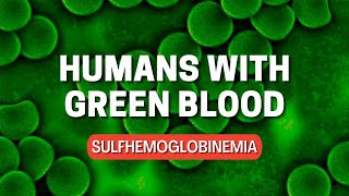 Humans with green blood  Sulfhemoglobinemia [upl. by Cirdnek]