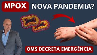 Mpox OMS Decreta EMERGÊNCIA Nova PANDEMIA  Dr Moacir Rosa [upl. by Lesser]