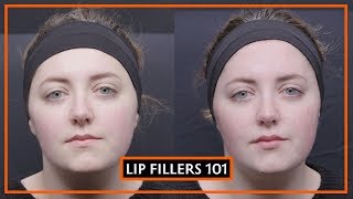 All About Lip Fillers  Dr Sarah Tonks [upl. by Hau]