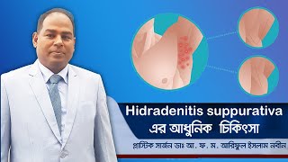 hidradenitis suppurativa এর আধুনিক চিকিৎসা [upl. by Ibbetson]