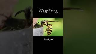 How to Remove Bee Sting [upl. by Aisetal338]