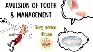 AVULSION  TRAUMATIC INJURIES OF TOOTH  MANAGEMENT endodontics [upl. by Marquez]