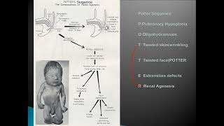 prenatal screening and diagnosis of congenital anomalies [upl. by Venable]