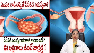 PCOD Symptoms And Causes amp Treatment  Polycystic Ovary Syndrome  Medi9HomeoAyurveda [upl. by Eicyal]