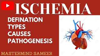 Ischemia  Ischemia In Hindi  Ischemia  Pathology  Physiology  Easy Tricks [upl. by Arahset894]