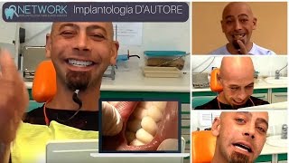 IMPLANTOLOGIA DENTALE PREZZI [upl. by Wolpert]