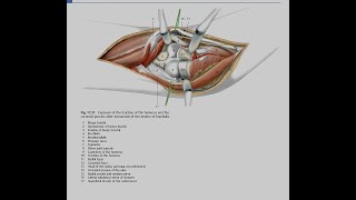 Anterior approach to the elbow [upl. by Esereht]