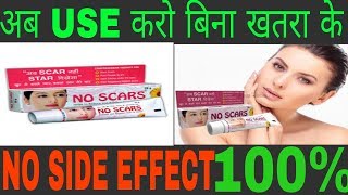 NO SCARS  side effect का Solutions 💯 working [upl. by February]