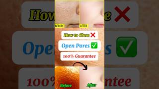 Best way to close open pores whitening skincare openporescreamhealthtime6469 ​⁠rclbeauty101 [upl. by Lowney]