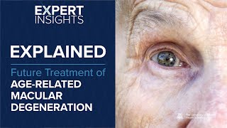 Expert Insights Future Treatment of AgeRelated Macular Degeneration [upl. by Nerin344]