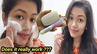 I Tried Kozicare Skin Lightening Soap amp Cream it worked Honest Review With Demo  Krrish Sarkar [upl. by Arela]