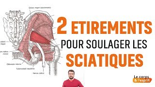 LES SCIATIQUES  Douleurs Bas du Dos Causes  Episode 7bis [upl. by Janenna]