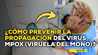 ¿Cómo se contagia el virus mpox o viruela del mono LASCOSASRPP  ENTREVISTA [upl. by Adrahc132]