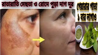 পেয়ারার পাতার সাথে ২ টা উপাদান মিশিয়ে লাগাও রাতারাতি মেছতা দূর হবেমুখের কালো দাগ দূর [upl. by Eneroc]