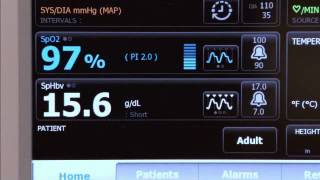 How To Taking a Pulse Oximetry Reading with Welch Allyn Connex Integrated Devices [upl. by Meridel]