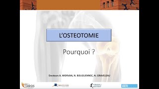 Pourquoi faire une ostéotomie [upl. by Remas]