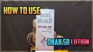 ONAK SR Resorcinolsulfur lotion amp Pretibenzyl 5 lotion BENZYL PEROXIDE review in Hindi [upl. by Delano]