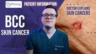 Basal Cell Carcinoma BCC Skin Cancer  Understanding the Most Common Skin Cancer [upl. by Elfreda]