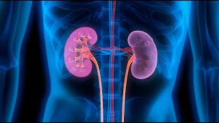 kidney transplantation and hypertensive nephrosclerosis [upl. by Veats]