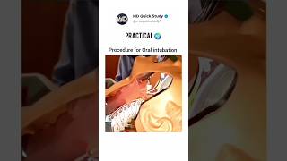 Procedure of Oral Intubation Practical  Science in Real 🌍 Life 3D Animation intubation practical [upl. by Tatiania]