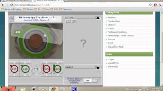 Retinoscopy Simulator Tutorial SPHCYL Method [upl. by Niltak]