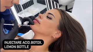 Injectare acid hialuronic  Botox amp Mami Lemon bottle [upl. by Damales]