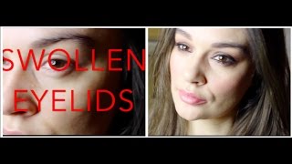 How to Cover Up Swollen Eyelids with Makeup [upl. by Atirrehs]