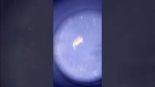 Дафния под микроскопом Water flea in the microscope [upl. by Aynat851]