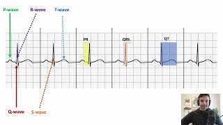 ECG crash course in 7min for nurses and medical students [upl. by Odraboel]