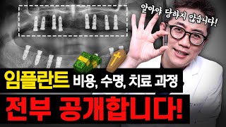 임플란트에 대한 모든 정보 대공개 더 이상 치과에서 당하지 마세요 [upl. by Werna]