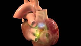 Sistema de conducción eléctrica del corazón [upl. by Demetrius]