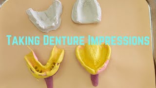 Taking Denture Impressions [upl. by Eimac145]