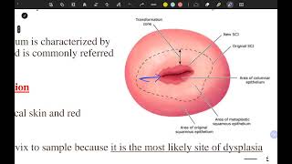 pap smear and colposcopy part 1 [upl. by Burnie]