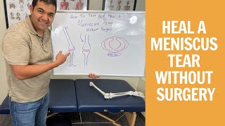 How To Test amp Heal A Meniscus Tear Without Surgery [upl. by Annadiana674]