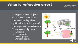 Refractive Error  A Patient Guide to Glasses [upl. by Ylra]