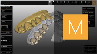 Uploading a waxup in ZirkonzahnModellier  ZirkonzahnSoftware [upl. by Auerbach]