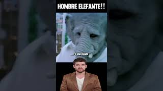 ✅HOMBRE ELEFANTE resumen peliculas shorts netflix movie resumenes resumenrapido [upl. by Leff]