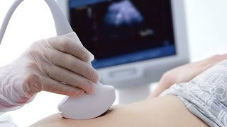 What causes absent fetal heartbeat in 12 week pregnancy scan  Dr Nupur Sood [upl. by Enelcaj]