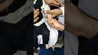 Cannula procedure easy pass youtubeyoutuberloveyoutubeshortsytshortsyoutubevideoyoutubevideos [upl. by Yniar17]