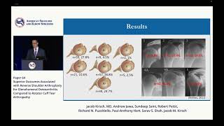 Superior Outcomes Associated with Reverse Shoulder Arthroplasty for Glenohumeral Osteoarthritis [upl. by Catha]