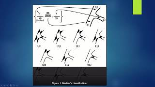 Dr nerien  bifurcation MD  Module 1 [upl. by Beghtol]