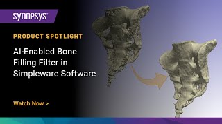 AIEnabled Bone Filling Filter in Simpleware Software [upl. by Aiuqram]