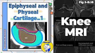 Fig 5B18 Normal Epiphyseal and Physeal Cartilage Part 1 [upl. by Uthrop]