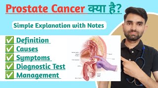 Prostate Cancer in Hindi  Risk Factors Symptoms And Treatment of Prostate Cancer [upl. by Harty]